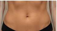Abdomen treatment area