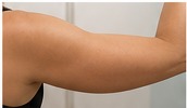 Arms treatment area