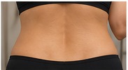 Back treatment area